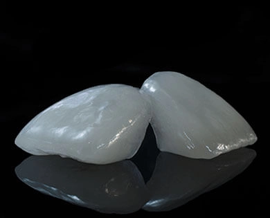 Veneers